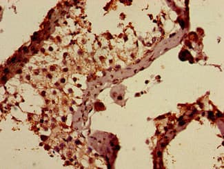 Polyclonal Rabbit anti-Human AP1S3 Antibody (Biotin, IHC, WB)