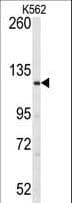 Polyclonal Rabbit anti-Human LATS1 Antibody (aa1-30, IHC, WB)