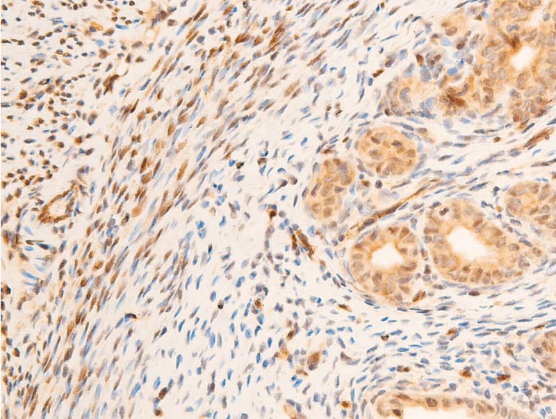 SGK1 / SGK Antibody (phospho-Ser422)
