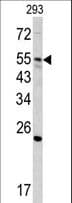 GNS Antibody (aa174-203)