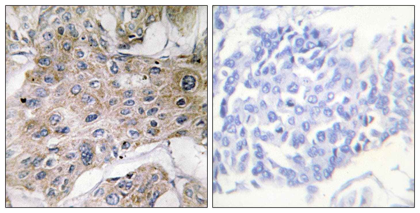 Polyclonal Rabbit anti-Human COX7A2 Antibody (IHC, WB)