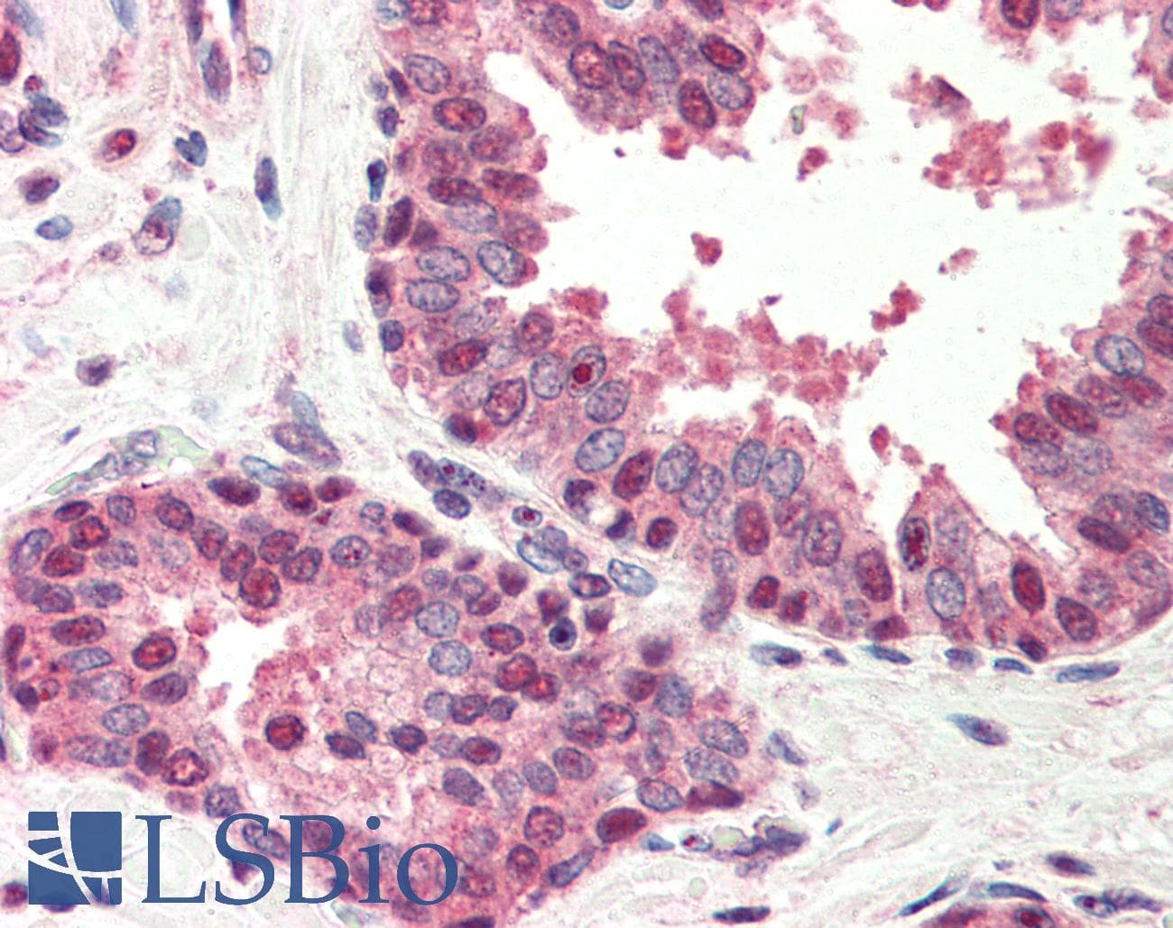 IHC-plus™ Polyclonal Rabbit anti-Human BIK Antibody (IHC, IF, WB)