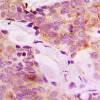 MRPL42 / MRPS32 Antibody (Internal)