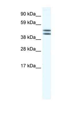 Polyclonal Rabbit anti-Human EGLN2 / PHD1 Antibody (aa58-107, IHC, WB)