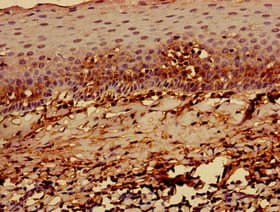 HLA-C Antibody