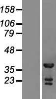 Human TSSC4 Protein (Over-Expression Lysate Myc-DDK (Flag))