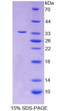 Human TOMM70A Protein (Recombinant His-T7)