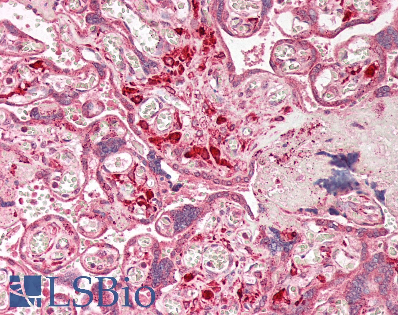 Polyclonal Rabbit anti-Human MKX Antibody (IHC, IF, WB)