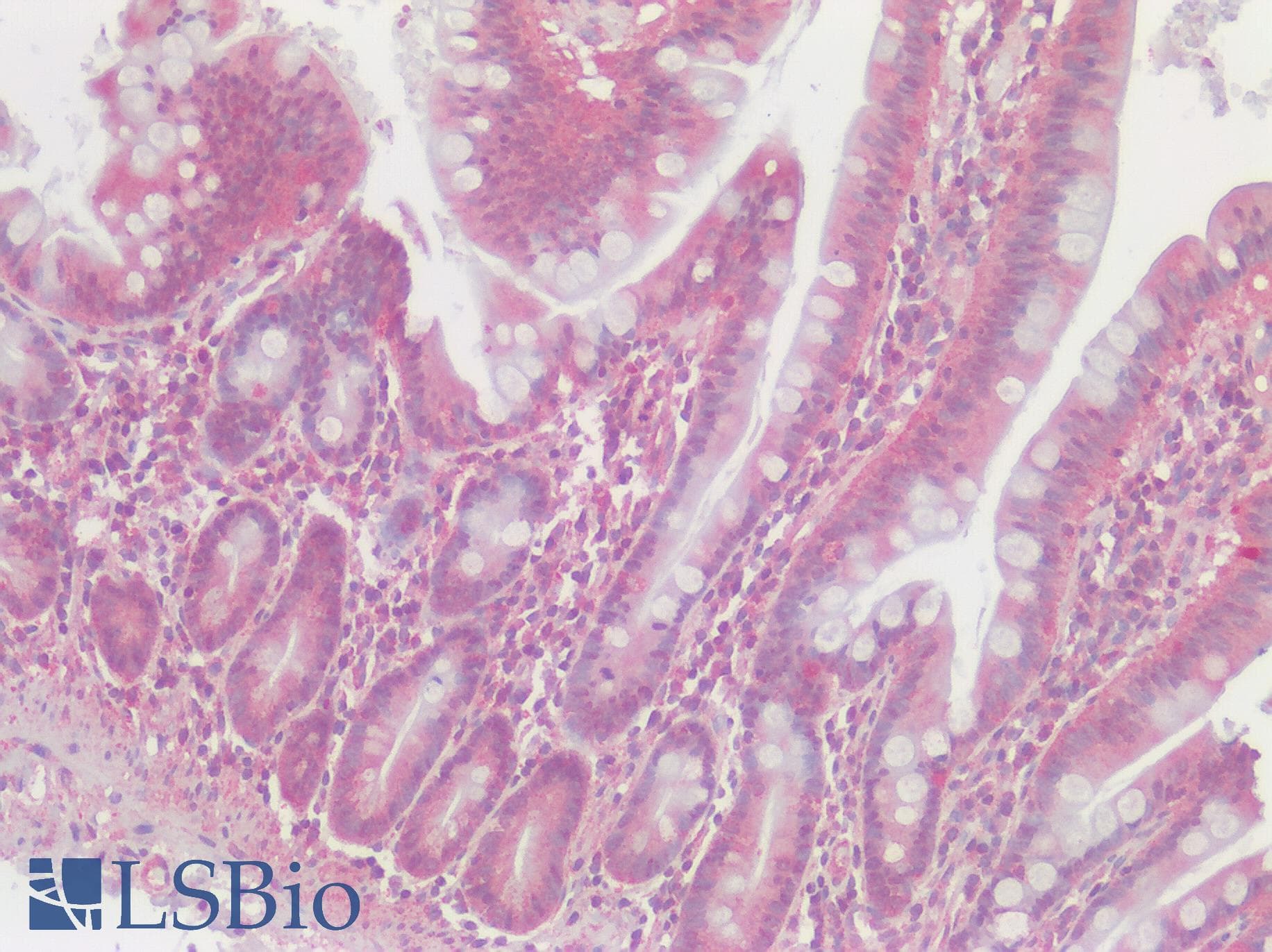 IHC-plus™ Polyclonal Rabbit anti-Human SLC29A1 / ENT1 Antibody (Internal, IHC)