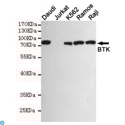 BTK Antibody