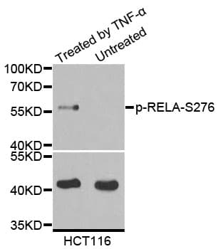 Polyclonal Rabbit anti-Human RELA / NFKB p65 Antibody (phospho-Ser276, IHC, IF, WB)
