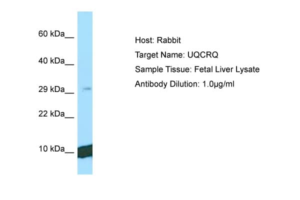 Polyclonal Rabbit anti-Human UQCRQ Antibody (C-Terminus, WB)