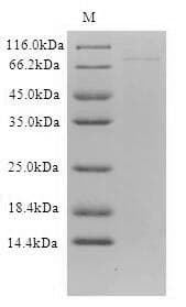 Human DCP1B Protein (Recombinant 6His-B2M, N-terminus)
