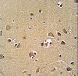 Polyclonal Rabbit anti-Human GPRASP1 / GASP-1 Antibody (aa1149-1176, IHC, WB)