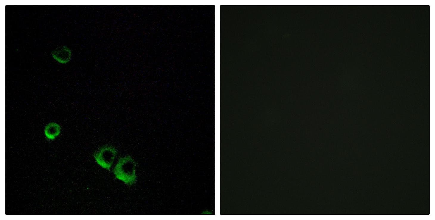 AVPR2 / V2R Antibody