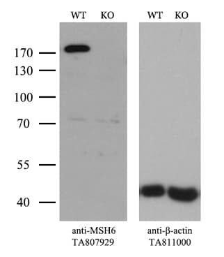 MSH6 Antibody (aa1-280, clone OTI5D1)