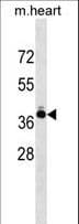 TNNT2 / CTNT Antibody (aa182-211)