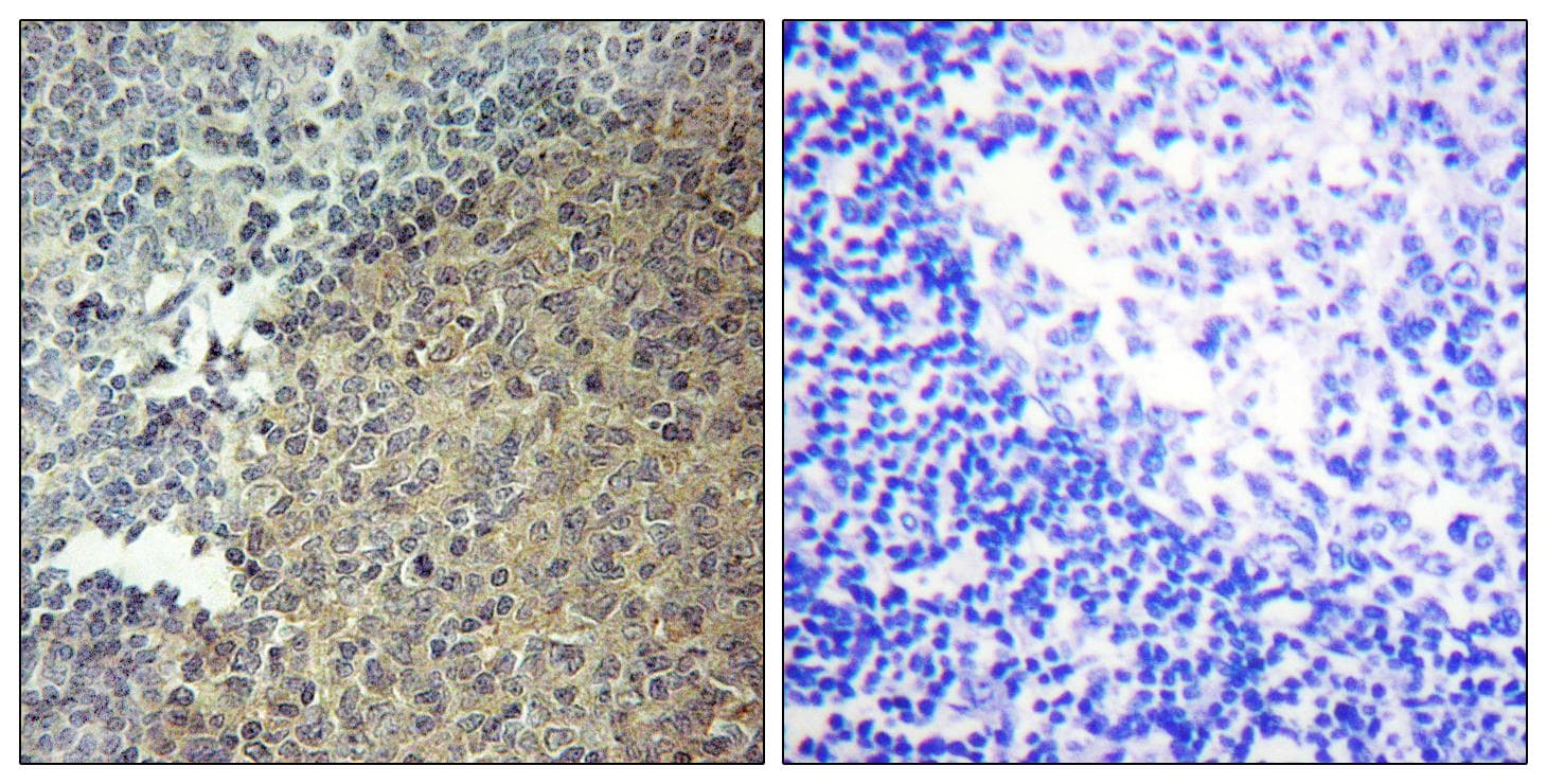 BLNK Antibody (p96)
