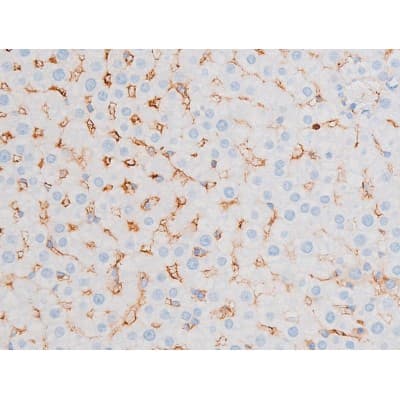PRKCQ / PKC-Theta Antibody (phospho-Ser676)