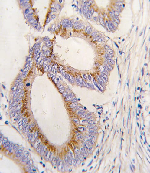 Polyclonal Rabbit anti-Human GDF11 / GDF-11 Antibody (aa32-61, IHC, WB)