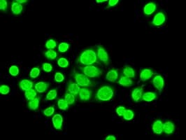 CHEK2 / CHK2 Antibody (clone OTI2F4)