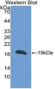 THBD / CD141 / Thrombomodulin Antibody (aa31-169)