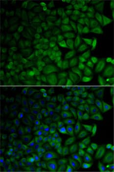 CD1D Antibody