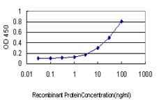 MTAP Antibody (clone 2G4)