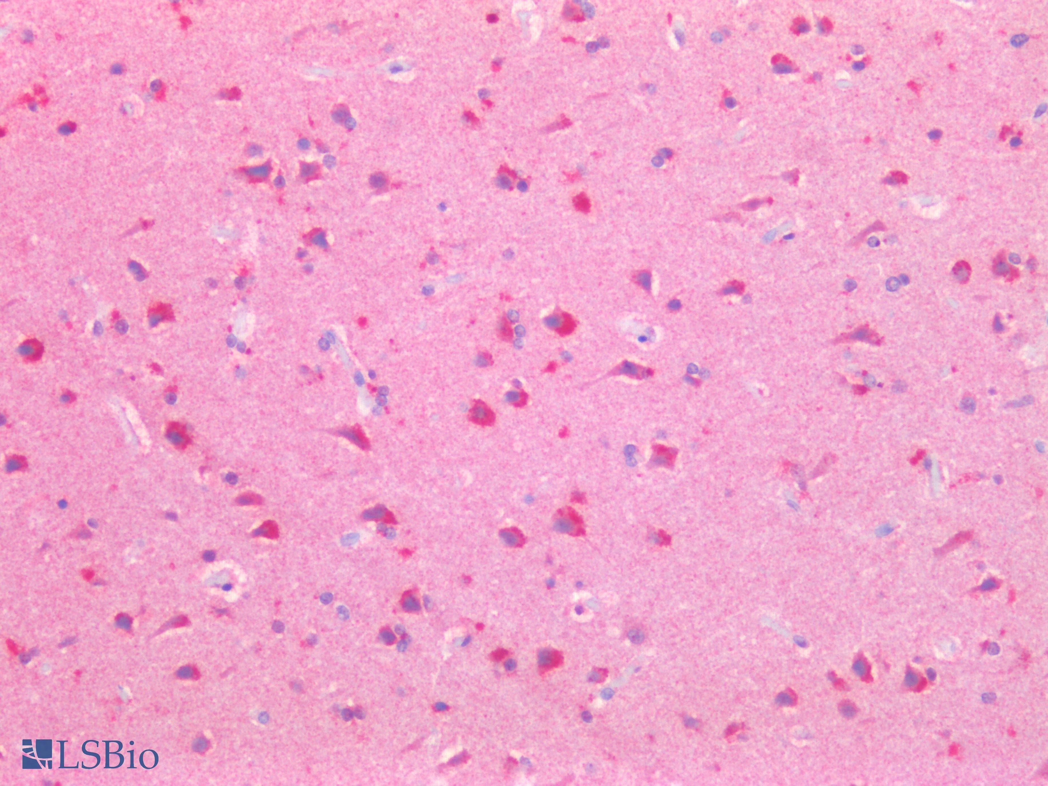 PathPlus™ PDGFRA / PDGFR Alpha Antibody