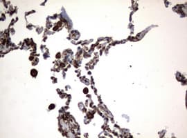 Monoclonal Mouse anti-Human Vimentin Antibody (clone OTI5D7, IHC, WB)