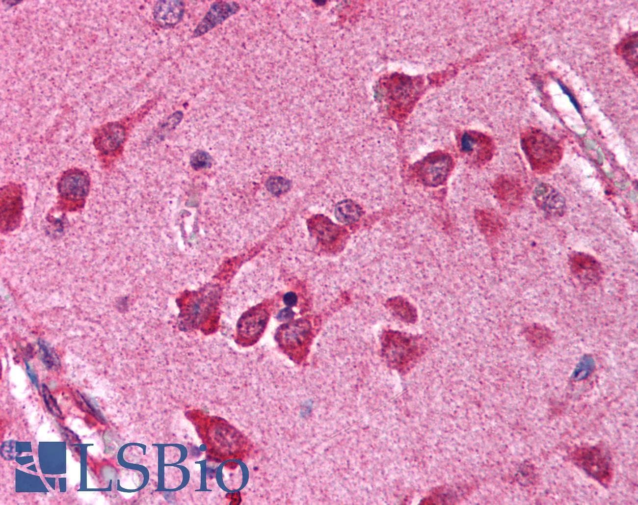 IHC-plus™ NFKBIA / IKB Alpha / IKBA Antibody (C-Terminus)