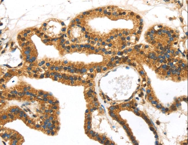 Polyclonal Rabbit anti-Human SERPINB8 Antibody (IHC)