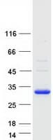 Human GUCD1 Protein (Recombinant Myc-DDK (Flag))