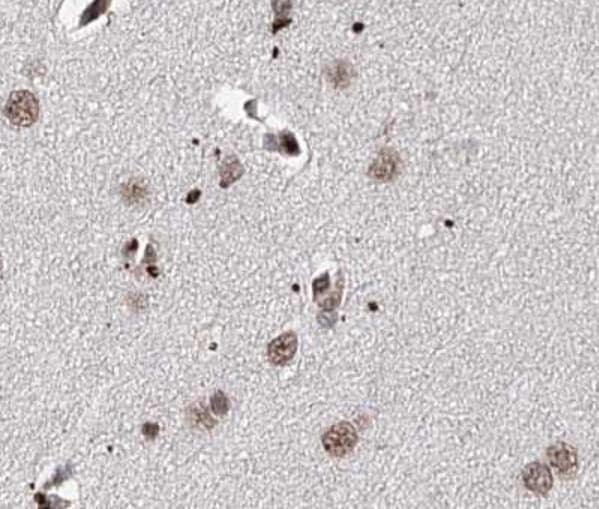 PDCD4 Antibody