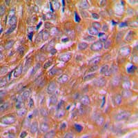 BNIP2 Antibody (Internal)