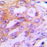 RPS6KB1 / P70S6K / S6K Antibody (Internal)