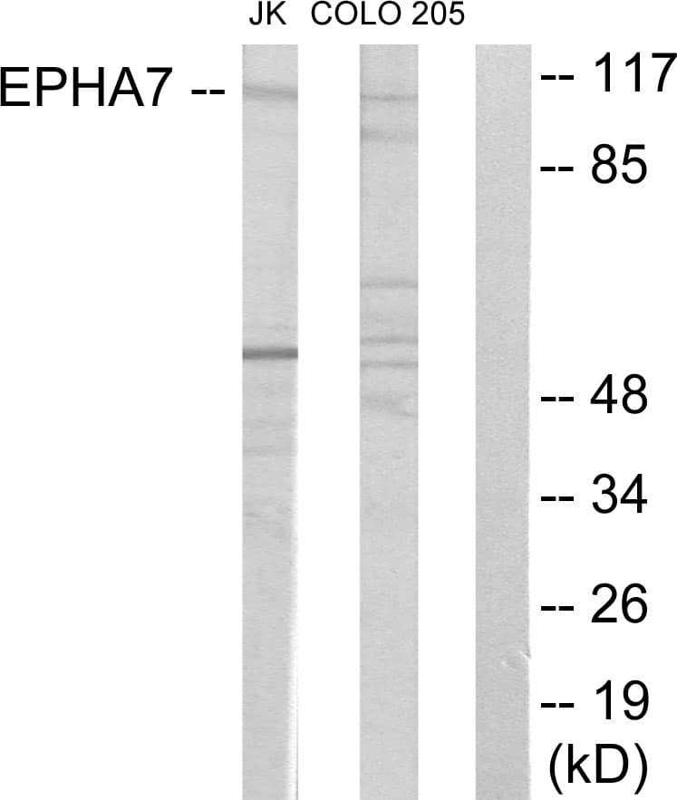 EPHA7 / EPH Receptor A7 Antibody (aa451-500)