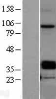 Osteoglycin / Mimecan Protein (Over-Expression Lysate Myc-DDK (Flag))