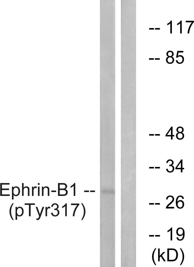 EFNB1 / Ephrin B1 Antibody (phospho-Tyr317)