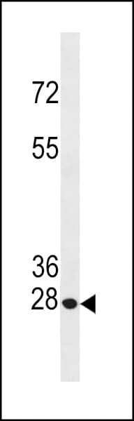 BCL2 / Bcl-2 Antibody (aa49-76)