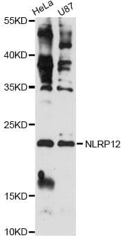 CSH1 / Placental Lactogen Antibody