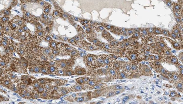 ZAP70 Antibody