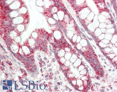 IHC-plus™ TSPO / PBR Antibody (C-Terminus)