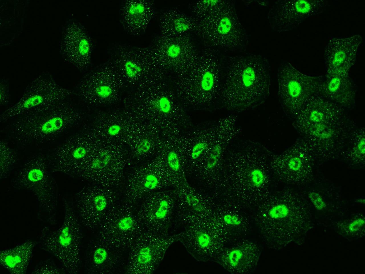 Polyclonal Rabbit anti-Human KYNU Antibody (IF)