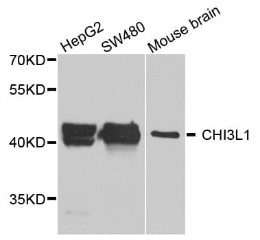 IHC-plus™ Polyclonal Rabbit anti-Human CHI3L1 / YKL-40 Antibody (IHC, WB)