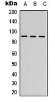 Polyclonal Rabbit anti-Human DDX24 Antibody (N-Terminus, WB)