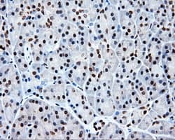 Monoclonal Mouse anti-Human TLDC1 / KIAA1609 Antibody (clone OTI5D9, IHC, IF, WB)