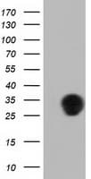 QPRT Antibody (clone OTI4E5)