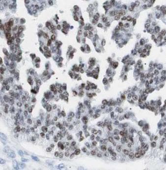 YAP / YAP1 Antibody