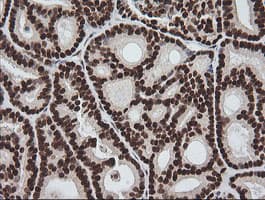 ZSCAN18 / ZNF447 Antibody (clone OTI4F12)